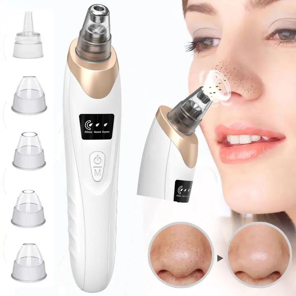 5-in-1 Professional Blackhead Remover Vacuum – Pore Cleaner & Facial Skin Renewal Kit