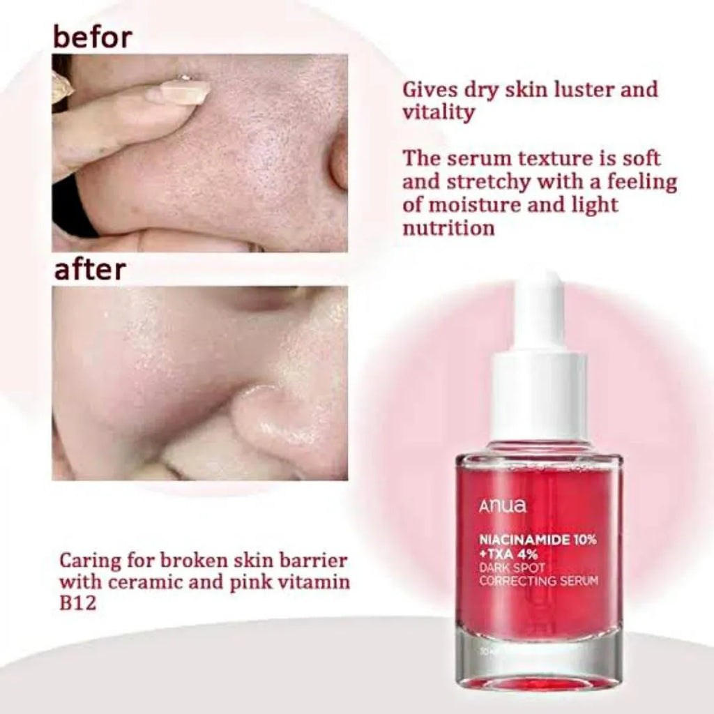 Anua Niacinamide 10% + TXA 4% Serum (30ml) – Advanced Dark Spot Correcting & Skin Brightening Formula