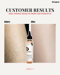 Urapra Glycolic Acid 7% Toning Solution – Advanced Exfoliating & Brightening Treatment (100ml)